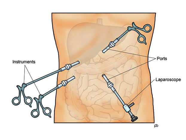 Hysteroscopy Laparoscopy & PRP