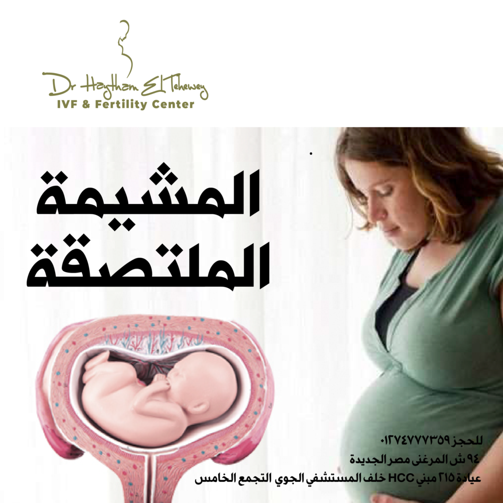 Placenta accreta causes no symptoms during pregnancy