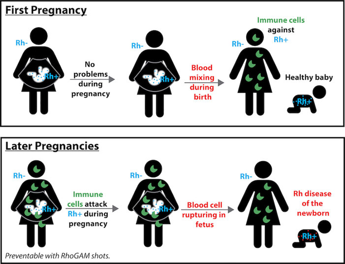 rh-disease-newborn